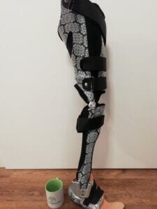 Ganzbeinorthese (KAFO) mit freilaufenden Kniegelenken Orthopädietechnik Klein